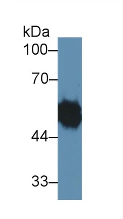 Western blot - Anti-LYAR antibody (AB233082)