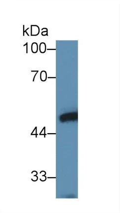 Western blot - Anti-LYAR antibody (AB233082)