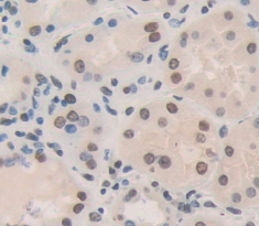 Immunohistochemistry (Formalin/PFA-fixed paraffin-embedded sections) - Anti-LYAR antibody (AB233408)