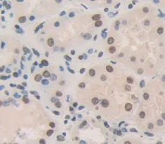 Immunohistochemistry (Formalin/PFA-fixed paraffin-embedded sections) - Anti-LYAR antibody (AB233408)