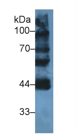 Western blot - Anti-LYAR antibody (AB233408)