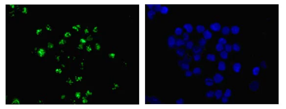 Immunocytochemistry/ Immunofluorescence - Anti-LYAR antibody [EPR14352-9] (AB182138)