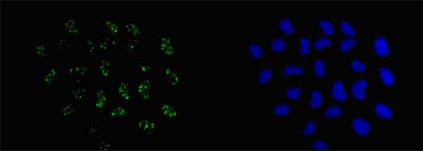 Immunocytochemistry/ Immunofluorescence - Anti-LYAR antibody [EPR14352] (AB181261), expandable thumbnail