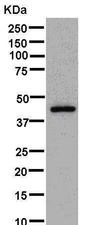 Western blot - Anti-LYAR antibody [EPR14352] (AB181261), expandable thumbnail