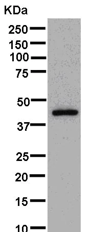 Western blot - Anti-LYAR antibody [EPR14352] - BSA and Azide free (AB250474)