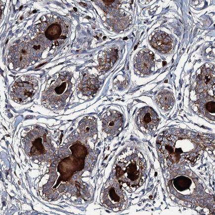 Immunohistochemistry (Formalin/PFA-fixed paraffin-embedded sections) - Anti-LYG2 antibody (AB243533)