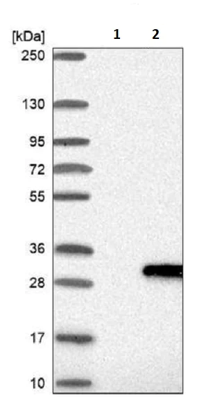 Western blot - Anti-LYG2 antibody (AB243533)