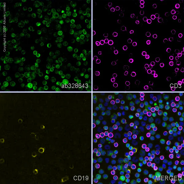 Anti-Lymphocyte cytosolic protein 2 antibody [EPR30409-43] (ab328643 ...