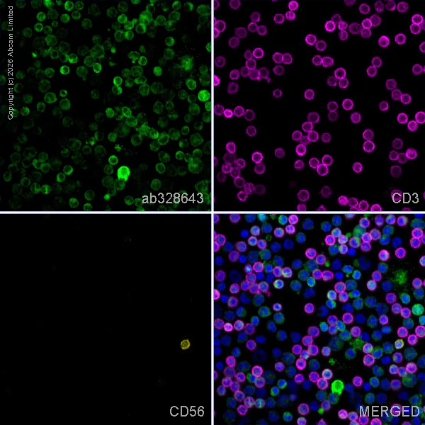 Anti-Lymphocyte cytosolic protein 2 antibody [EPR30409-43] (ab328643 ...