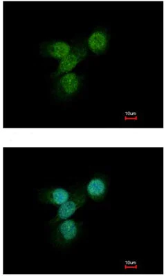 Immunocytochemistry/ Immunofluorescence - Anti-Lyn antibody (AB137338)