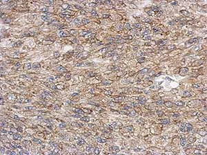 Immunohistochemistry (Formalin/PFA-fixed paraffin-embedded sections) - Anti-Lyn antibody (AB137338)