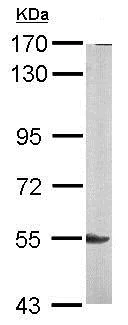 Western blot - Anti-Lyn antibody (AB137338)