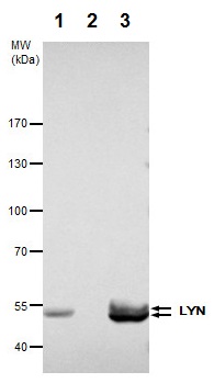 Immunoprecipitation - Anti-Lyn antibody (AB227170), expandable thumbnail