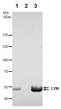 Immunoprecipitation - Anti-Lyn antibody (AB227170)