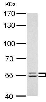 Western blot - Anti-Lyn antibody (AB227170), expandable thumbnail