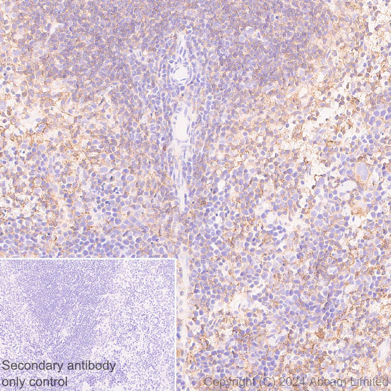 Immunohistochemistry (Formalin/PFA-fixed paraffin-embedded sections) - Anti-Lyn antibody [EPR28556-68] (AB318191)