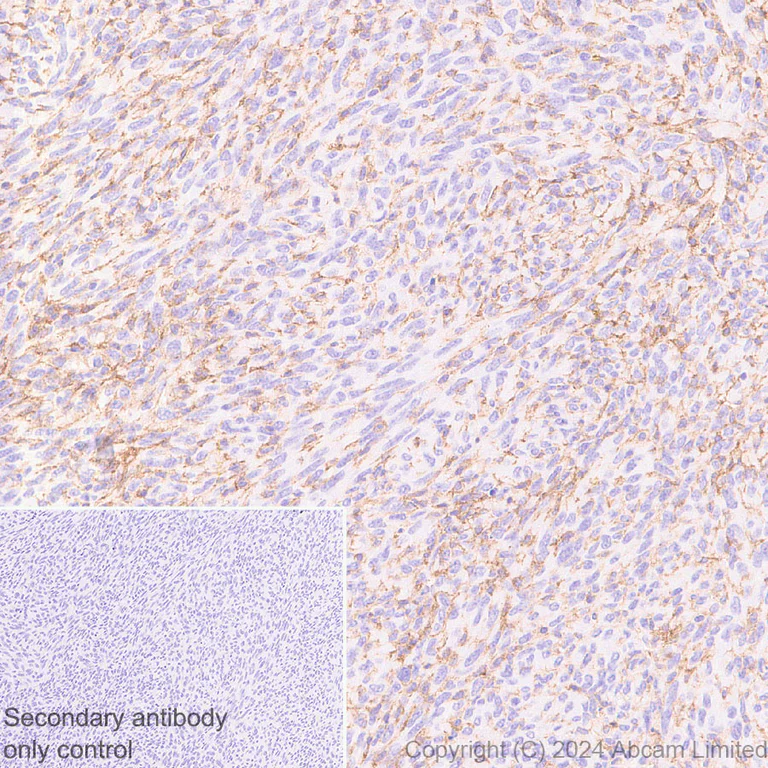 Immunohistochemistry (Formalin/PFA-fixed paraffin-embedded sections) - Anti-Lyn antibody [EPR28556-68] (AB318191)
