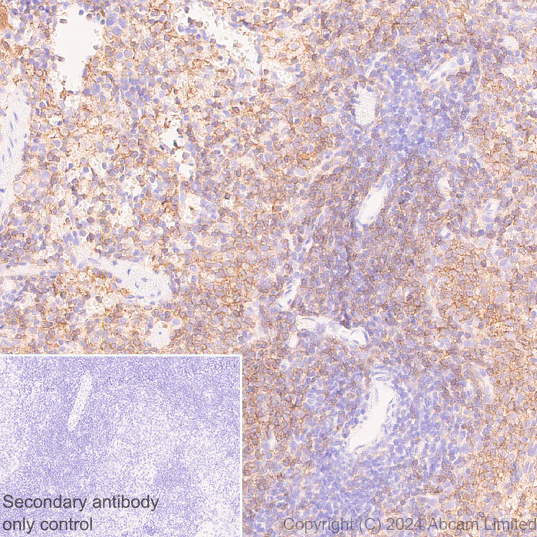 Immunohistochemistry (Formalin/PFA-fixed paraffin-embedded sections) - Anti-Lyn antibody [EPR28556-68] (AB318191)