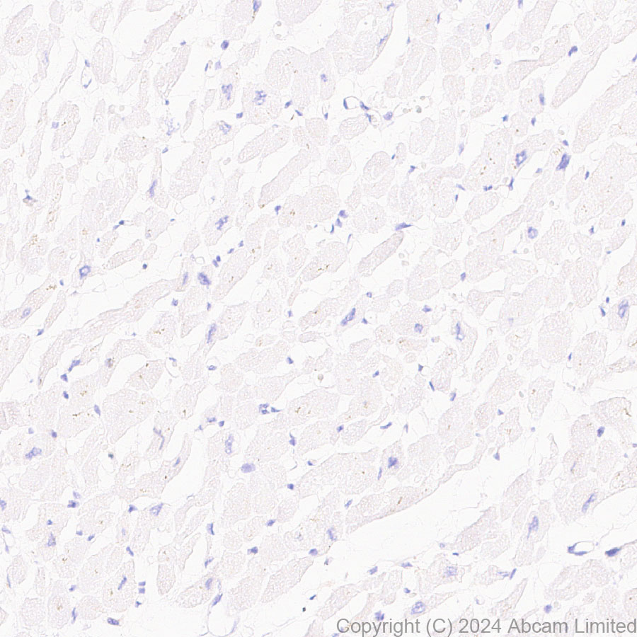 Immunohistochemistry (Formalin/PFA-fixed paraffin-embedded sections) - Anti-Lyn antibody [EPR28556-68] (AB318191)