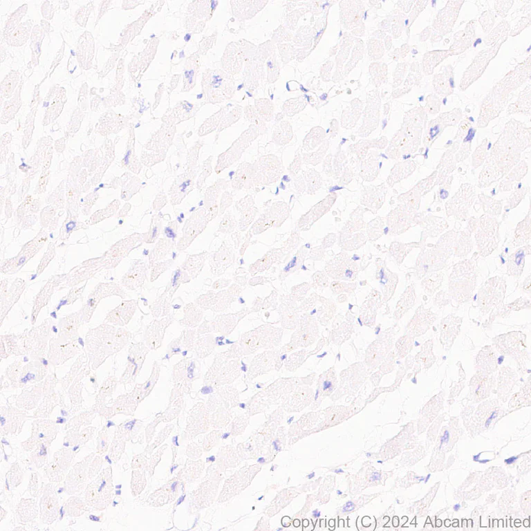 Immunohistochemistry (Formalin/PFA-fixed paraffin-embedded sections) - Anti-Lyn antibody [EPR28556-68] (AB318191)