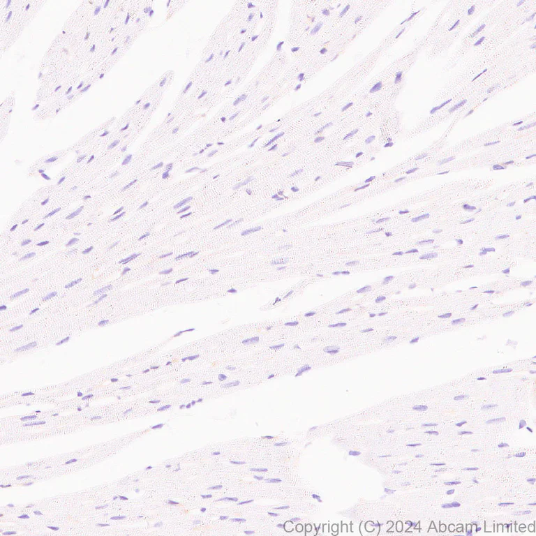 Immunohistochemistry (Formalin/PFA-fixed paraffin-embedded sections) - Anti-Lyn antibody [EPR28556-68] (AB318191)