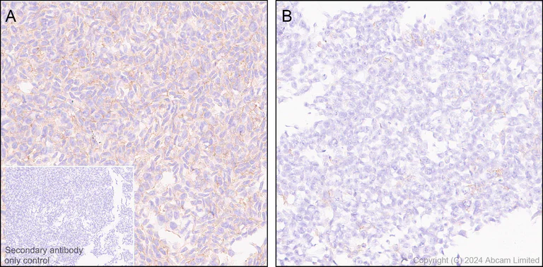 Immunohistochemistry (Formalin/PFA-fixed paraffin-embedded sections) - Anti-Lyn antibody [EPR28556-68] (AB318191)