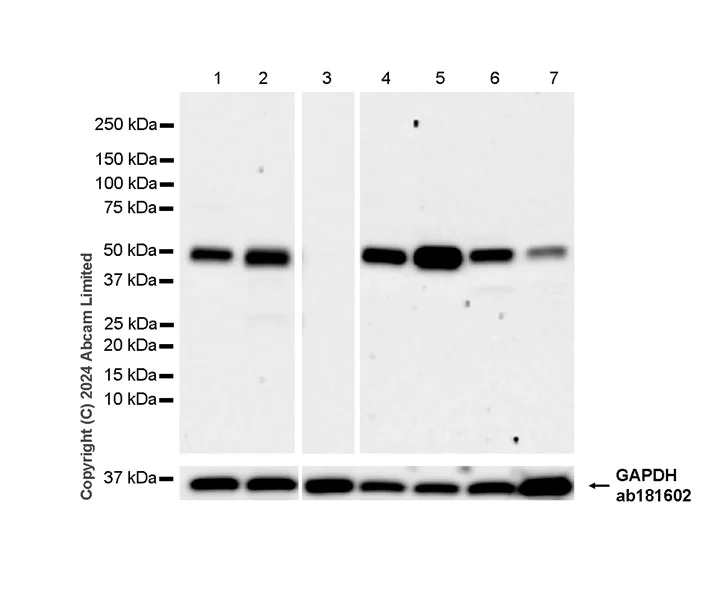 Western blot - Anti-Lyn antibody [EPR28556-68] (AB318191)