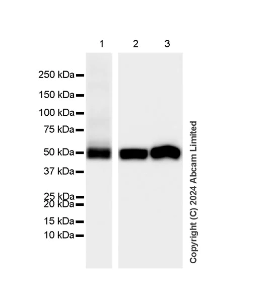 Western blot - Anti-Lyn antibody [EPR28556-68] (AB318191)