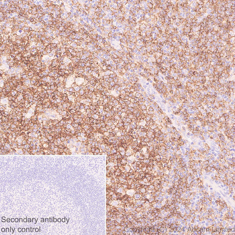 Immunohistochemistry (Formalin/PFA-fixed paraffin-embedded sections) - Anti-Lyn antibody [EPR28556-68] - BSA and Azide free (AB318192)
