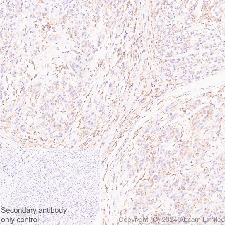 Immunohistochemistry (Formalin/PFA-fixed paraffin-embedded sections) - Anti-Lyn antibody [EPR28556-68] - BSA and Azide free (AB318192)