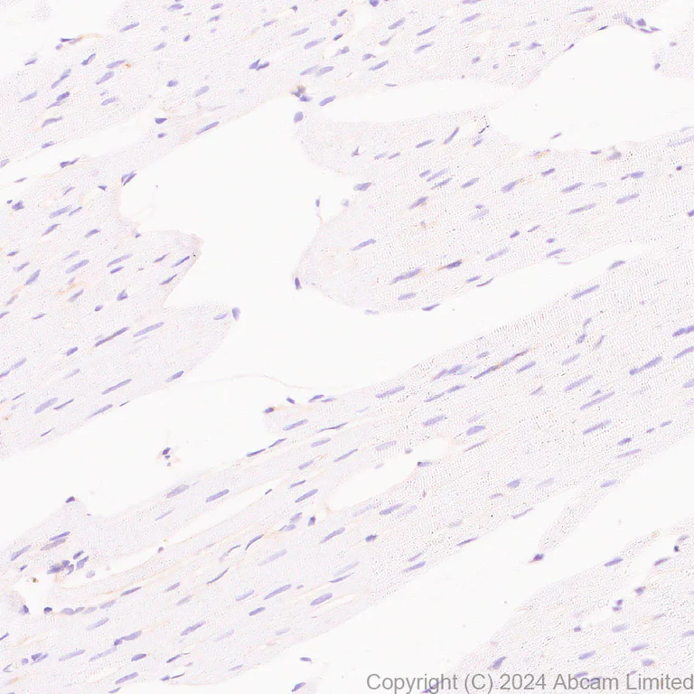 Immunohistochemistry (Formalin/PFA-fixed paraffin-embedded sections) - Anti-Lyn antibody [EPR28556-68] - BSA and Azide free (AB318192)