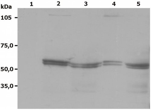 Western blot - Anti-Lyn antibody [LYN-01] (AB1890), expandable thumbnail