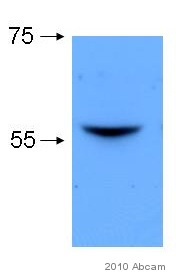 Western blot - Anti-Lyn antibody [LYN-01] (AB1890), expandable thumbnail