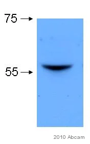 Western blot - Anti-Lyn antibody [LYN-01] (AB1890)