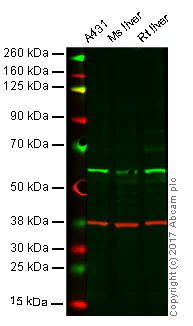 Western blot - Anti-Lyn antibody [Y497] (AB32398)