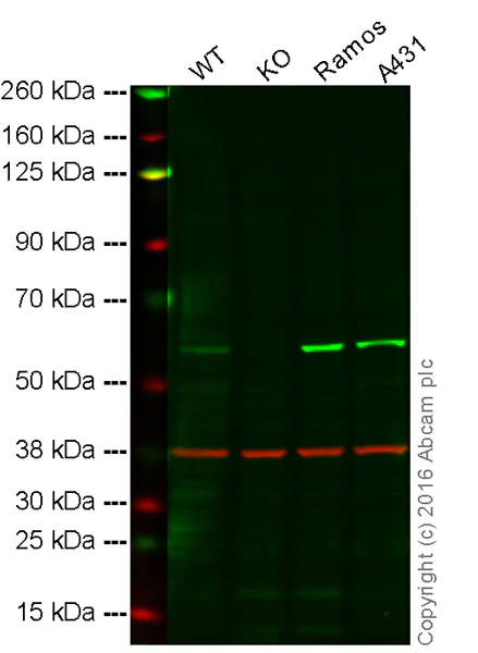 Western blot - Anti-Lyn antibody [Y497] (AB32398)