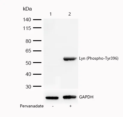 Western blot - Anti-Lyn (phospho Y396) antibody [SR2011] (AB326658)