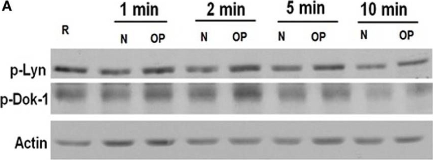 Western blot - Anti-Lyn (phospho Y397) antibody (AB226778)