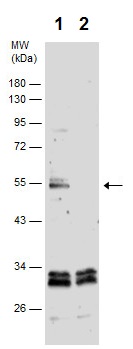 Western blot - Anti-Lyn (phospho Y397) antibody (AB226778)