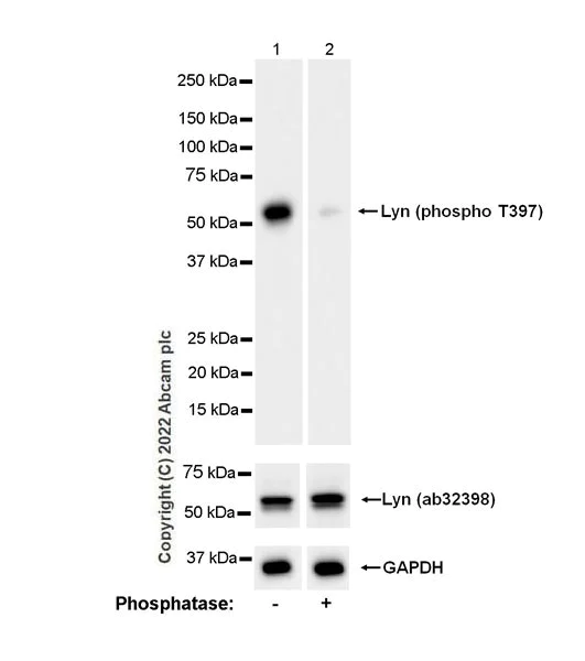 Western blot - Anti-Lyn (phospho Y397) antibody [EPR26354-1] (BSA and Azide free) (AB300119)