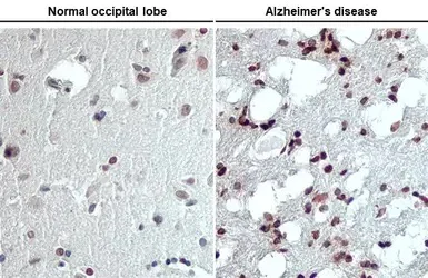 Immunohistochemistry (Formalin/PFA-fixed paraffin-embedded sections) - Anti-Lyn (phospho Y397) antibody [HL122] - BSA and Azide free (AB289371)