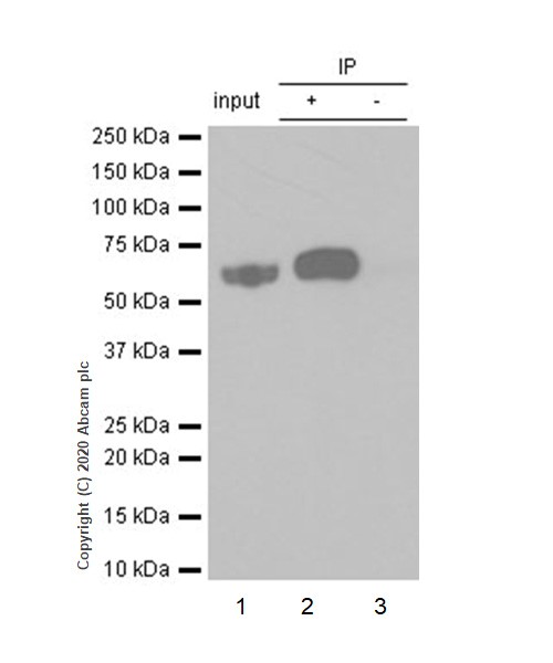 Immunoprecipitation - Anti-Lyn (phospho Y507) antibody [EP504Y] (AB33914), expandable thumbnail