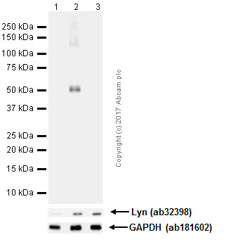 Western blot - Anti-Lyn (phospho Y507) antibody [EP504Y] (AB33914), expandable thumbnail