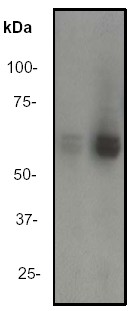 Western blot - Anti-Lyn (phospho Y507) antibody [EP504Y] (AB33914), expandable thumbnail