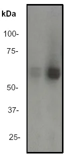 Western blot - Anti-Lyn (phospho Y507) antibody [EP504Y] (AB33914)