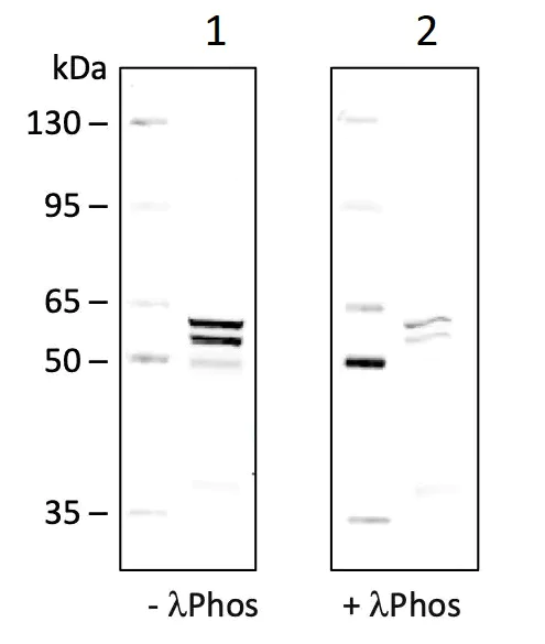 Western blot - Anti-Lyn (phospho Y507) antibody [LynY507-5B6] (AB278639)