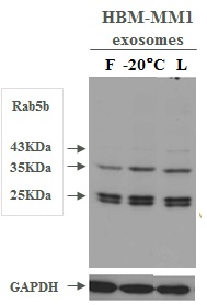 Western blot - Lyophilized Exosome Standard (100 µg, Human Urine) (AB286884), expandable thumbnail