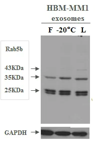 Western blot - Lyophilized Exosome Standard (100 µg, Human Urine) (AB286884)