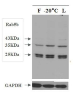 Western blot - Lyophilized Exosome Standard (Human Plasma) (AB288118), expandable thumbnail