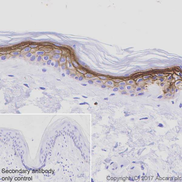 Immunohistochemistry (Formalin/PFA-fixed paraffin-embedded sections) - Anti-LYPD3 antibody [EPR9107] (AB151709)